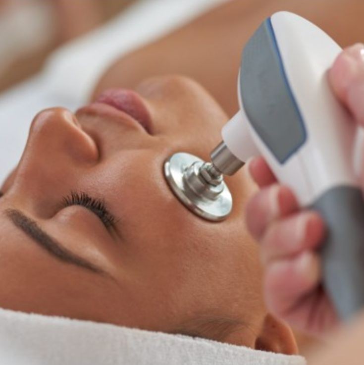 Radiofrecuencia facial