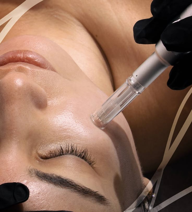 tratamientos Regenerador facial